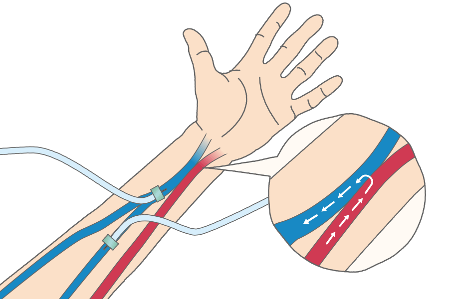 飯田橋春口クリニック主催「第2回未来のバスキュラーアクセスを妄想するワークショップ」に代表理事 宿野部が登壇しました。